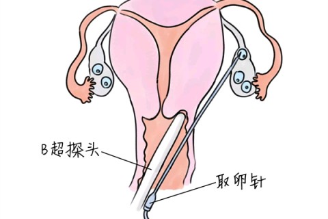 http://shaoxing.vdtfzz.com/post/205.html|绍兴供卵助孕
