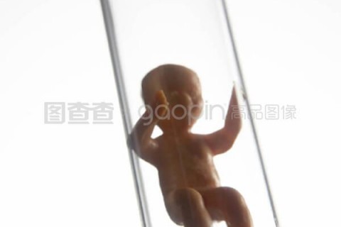 http://shaoxing.vdtfzz.com/post/197.html|绍兴试管助孕